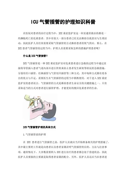 ICU气管插管的护理知识科普