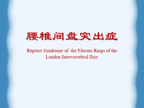 腰椎间盘突出症