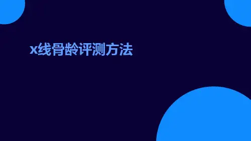 X线骨龄评测方法