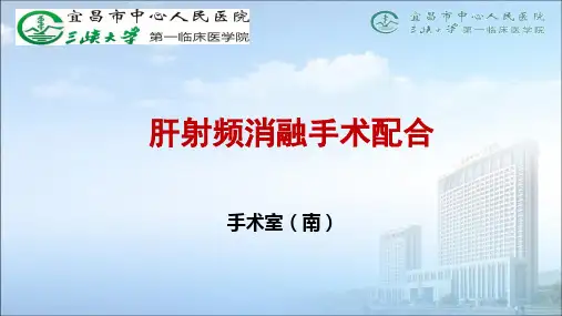 肝射频消融手术配合