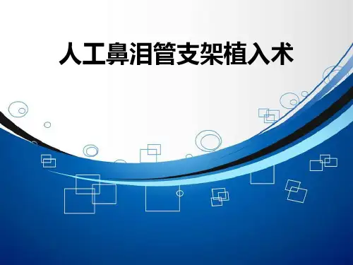 人工鼻泪管支架植入术