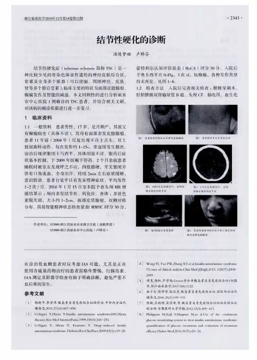 结节性硬化的诊断