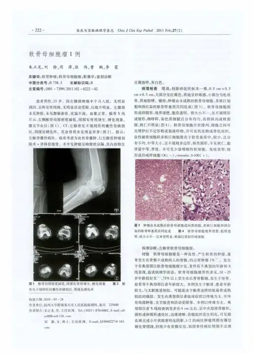 软骨母细胞瘤1例