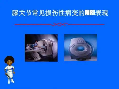 2膝关节常见损伤性病变的MR表现