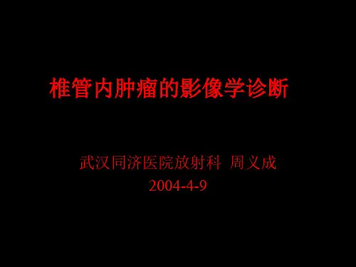 椎管内肿瘤的影像学诊断