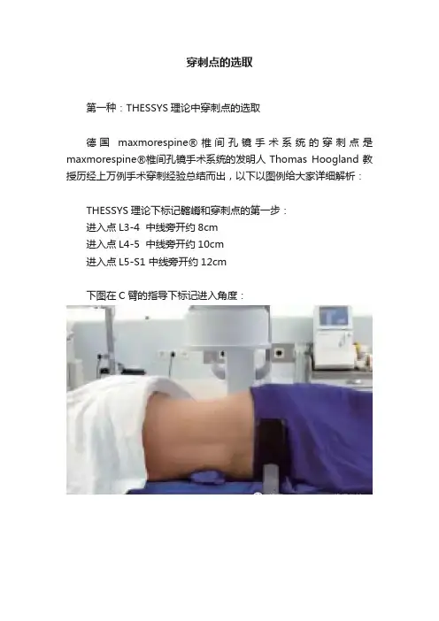 穿刺点的选取