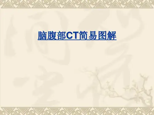 胸腹部CT简易图解