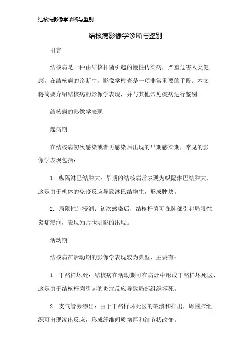 结核病影像学诊断与鉴别