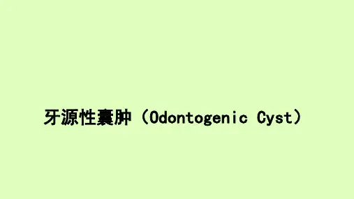 牙源性囊肿影像