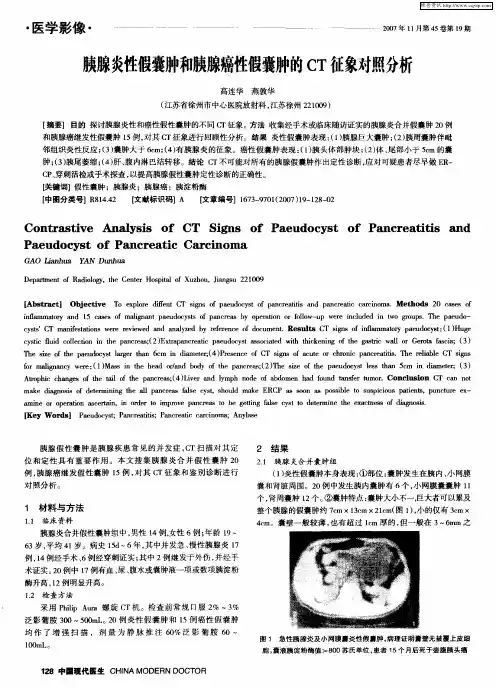 胰腺炎性假囊肿和胰腺癌性假囊肿的CT征象对照分析