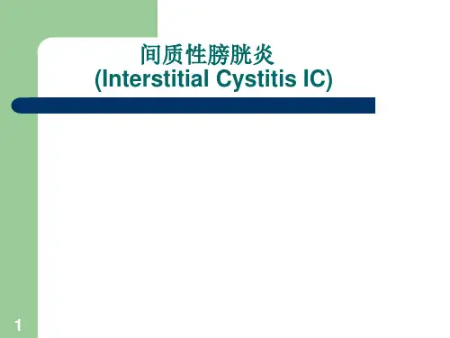 间质性膀胱炎ppt课件