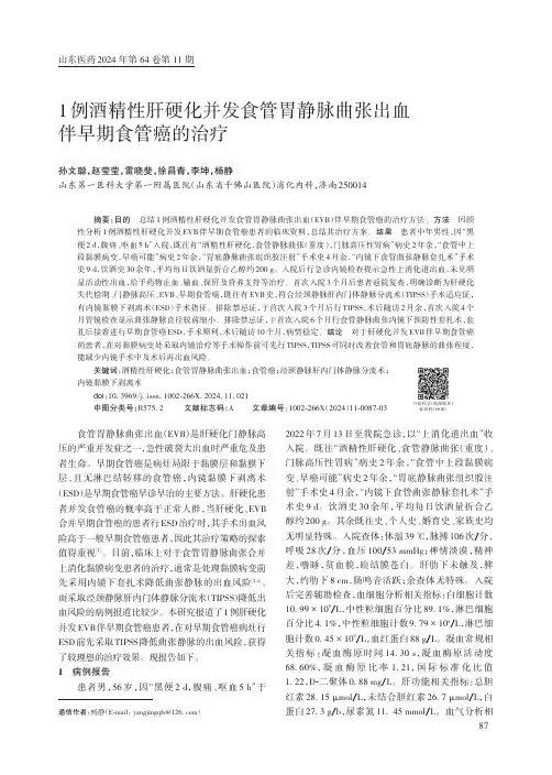 1_例酒精性肝硬化并发食管胃静脉曲张出血伴早期食管癌的治疗