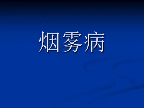 烟雾病