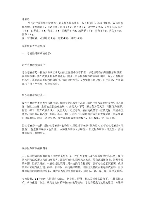 荨麻诊