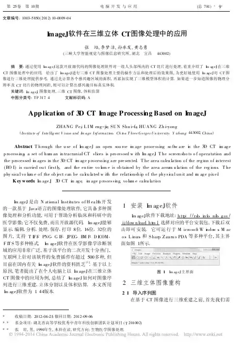 ImageJ软件在三维立体CT图像处理中的应用