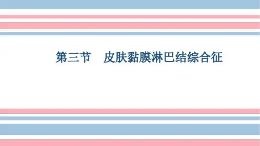 儿科中医-川崎病