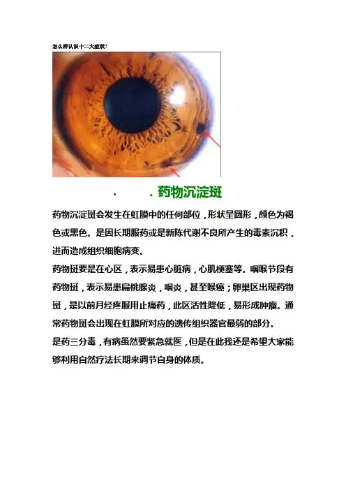 怎么样认识十二大症状