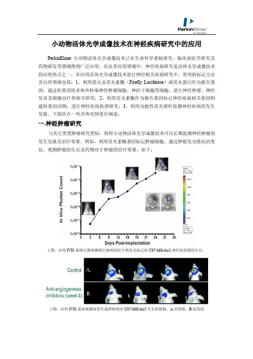 小动物活体光学成像在神经性疾病研究中的应用