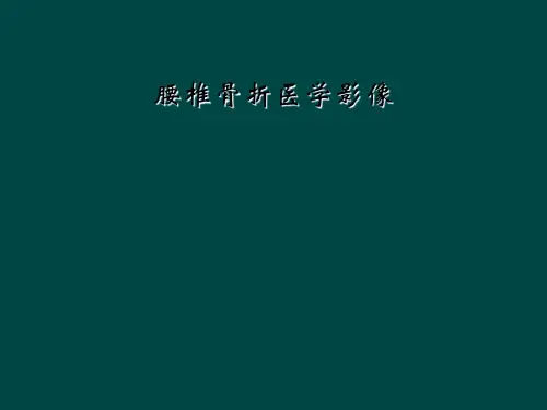 腰椎骨折医学影像