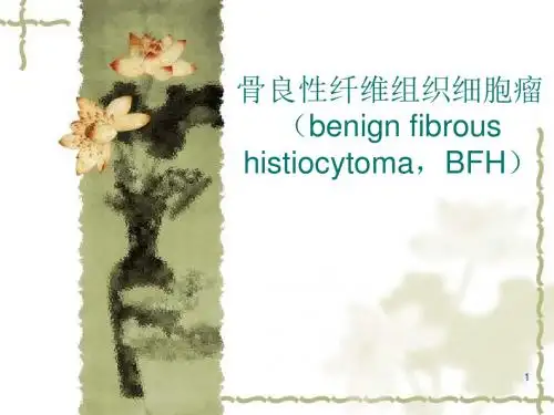 良性纤维组织细胞瘤ppt课件