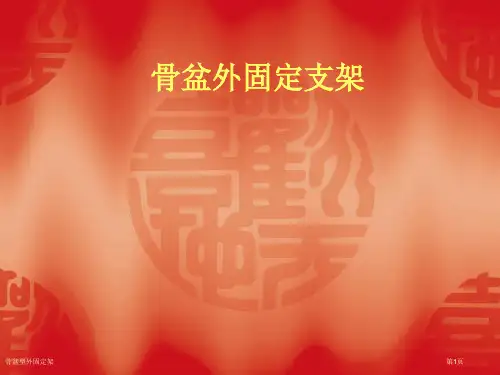 骨盆型外固定架
