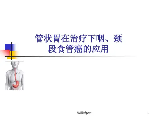 管状胃代食管PPT课件