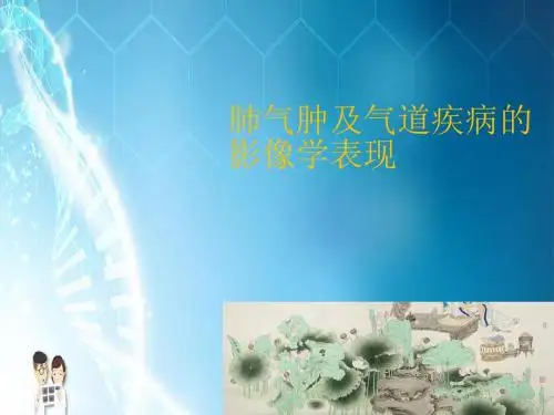 肺气肿及气道疾病的影像学表现PPT课件