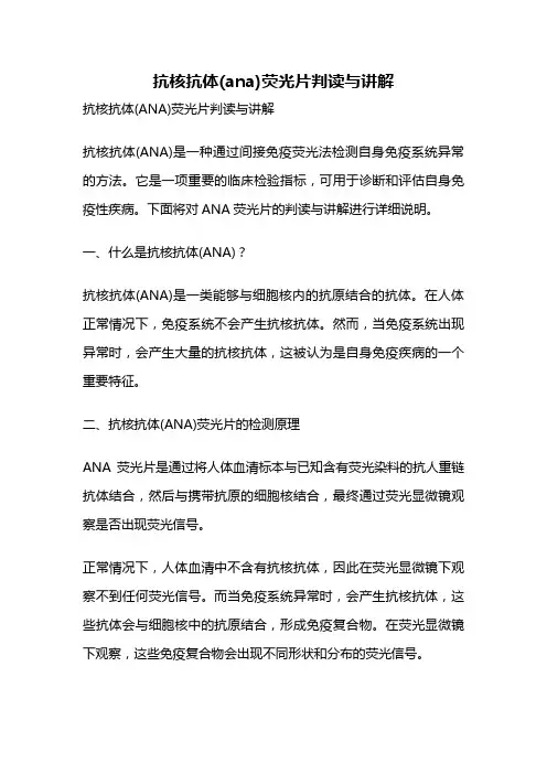 抗核抗体(ana)荧光片判读与讲解