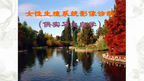 女性生殖系统影像诊断ppt课件