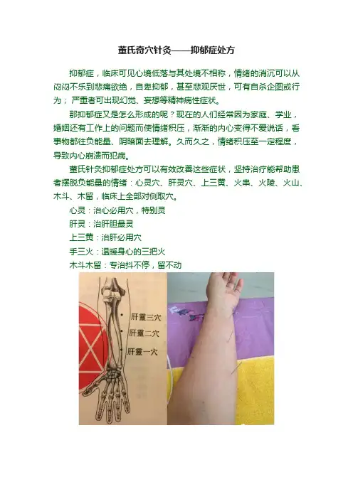 董氏奇穴针灸——抑郁症处方