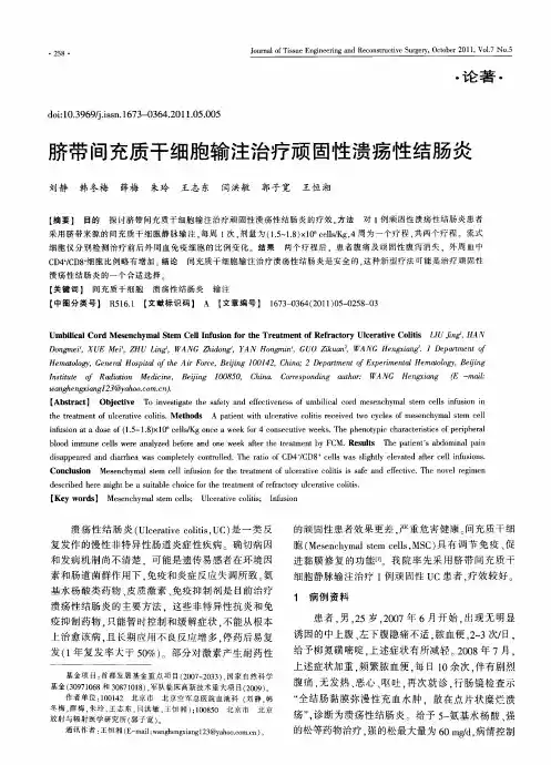 脐带间充质干细胞输注治疗顽固性溃疡性结肠炎