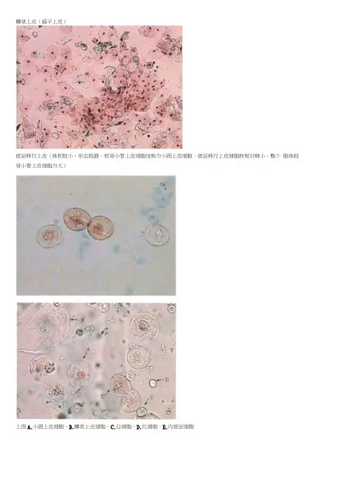 尿沉渣图谱第二册
