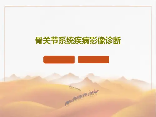 骨关节系统疾病影像诊断193页PPT