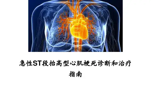 急性ST段抬高型心肌梗死诊断和治疗指南(2019)