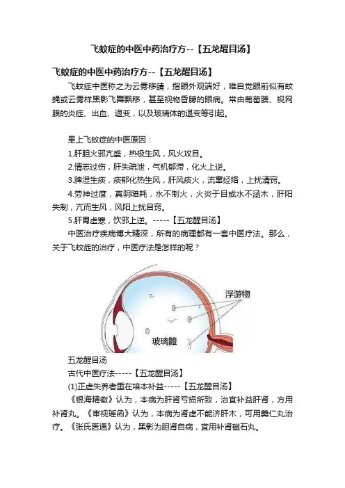 飞蚊症的中医中药治疗方--【五龙醒目汤】