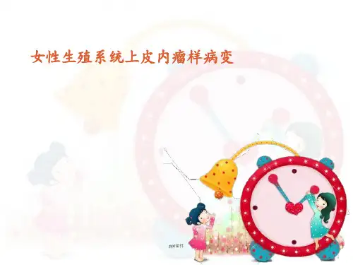 女性生殖系统上皮内瘤样  ppt课件