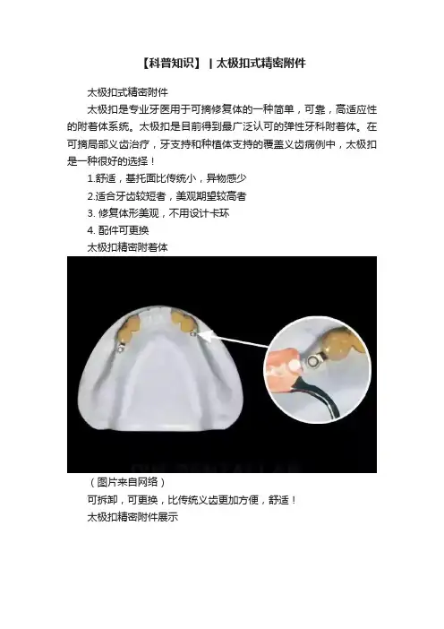 【科普知识】丨太极扣式精密附件