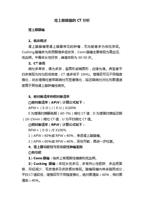 肾上腺腺瘤的CT分析
