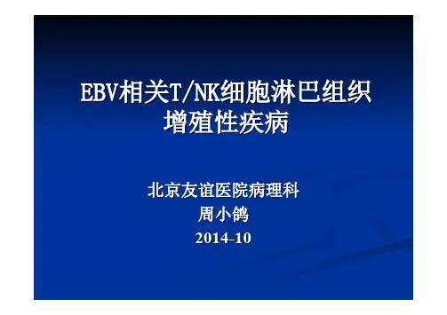 (仅供参考)EBV相关TNK细胞淋巴组织 增殖性疾病