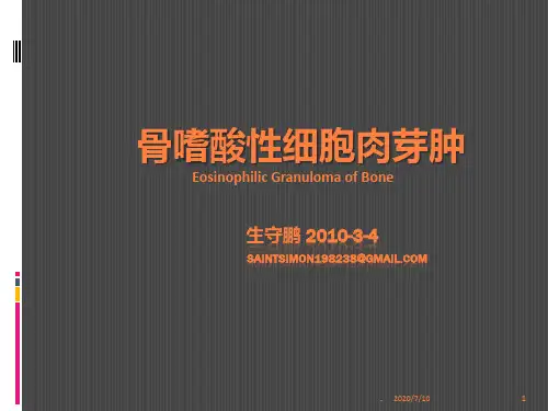 骨嗜酸性肉芽肿ppt课件