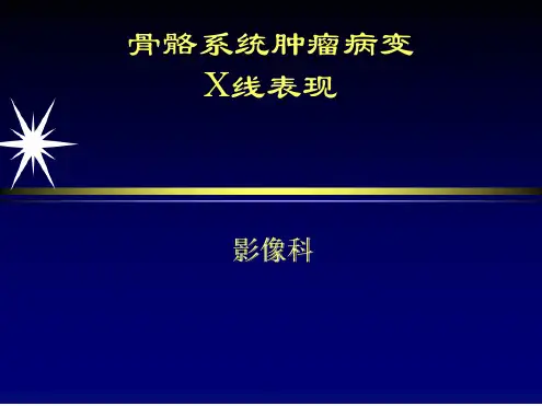 骨肿瘤影像学培训
