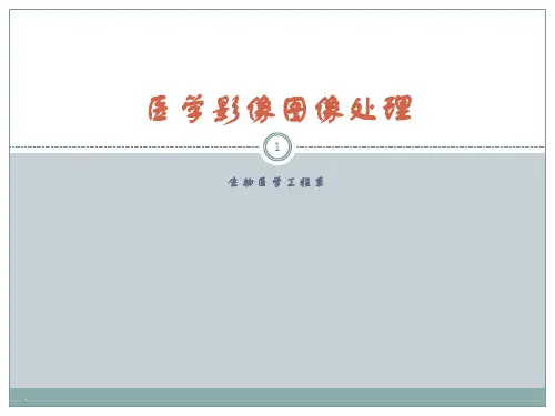 医学图像配准与融合ppt课件