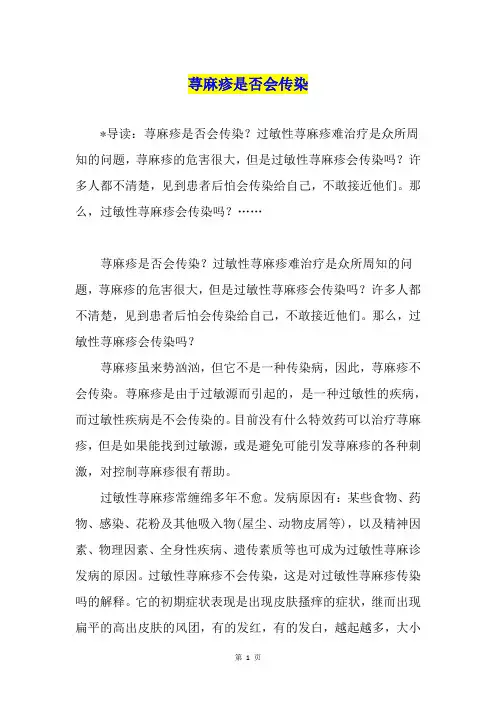 荨麻疹是否会传染