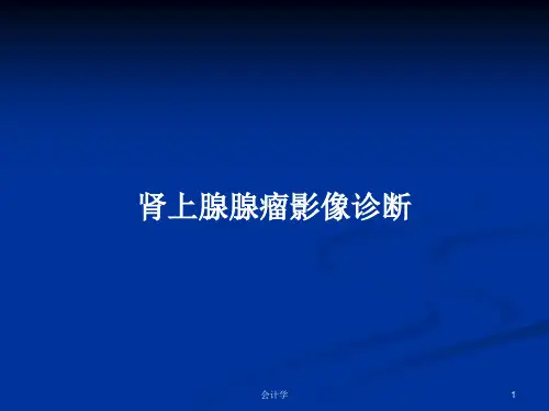 肾上腺腺瘤影像诊断PPT学习教案