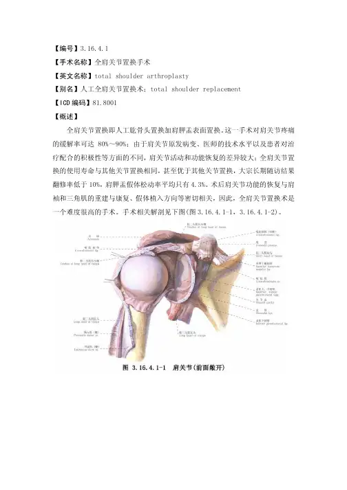 【编号】 【手术名称】全肩关节置换手术
