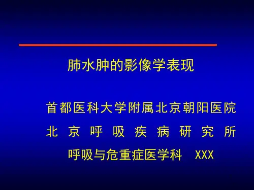 肺水肿影像学表现ppt课件