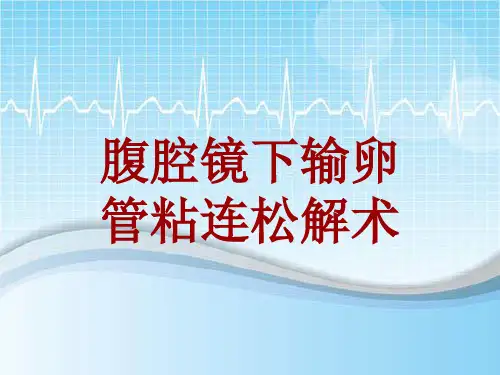 手术讲解模板：腹腔镜下输卵管粘连松解术