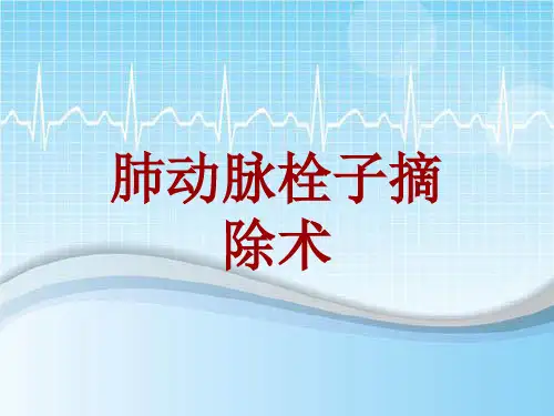 手术讲解模板：肺动脉栓子摘除术