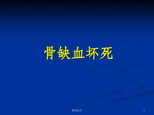《骨缺血坏死》PPT课件