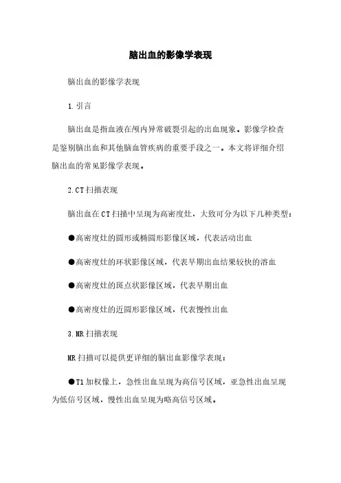 脑出血的影像学表现